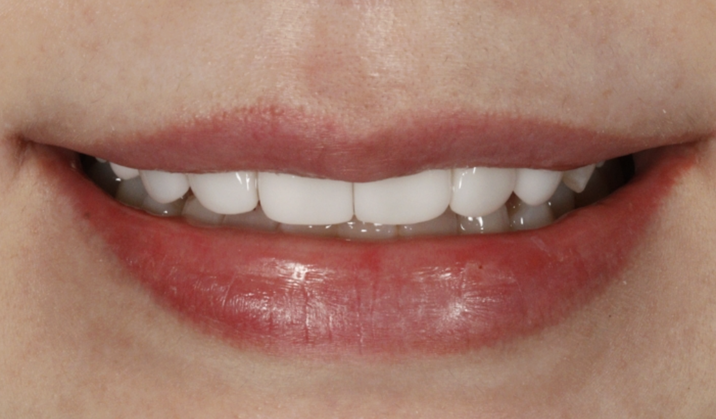 김○○님 치료 후