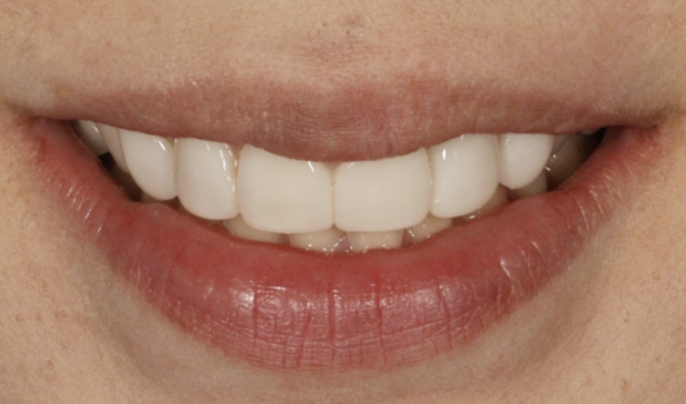 박○○님 치료 후