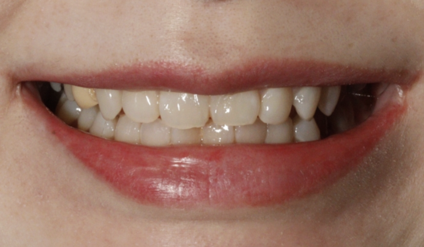 김○○님 치료 전