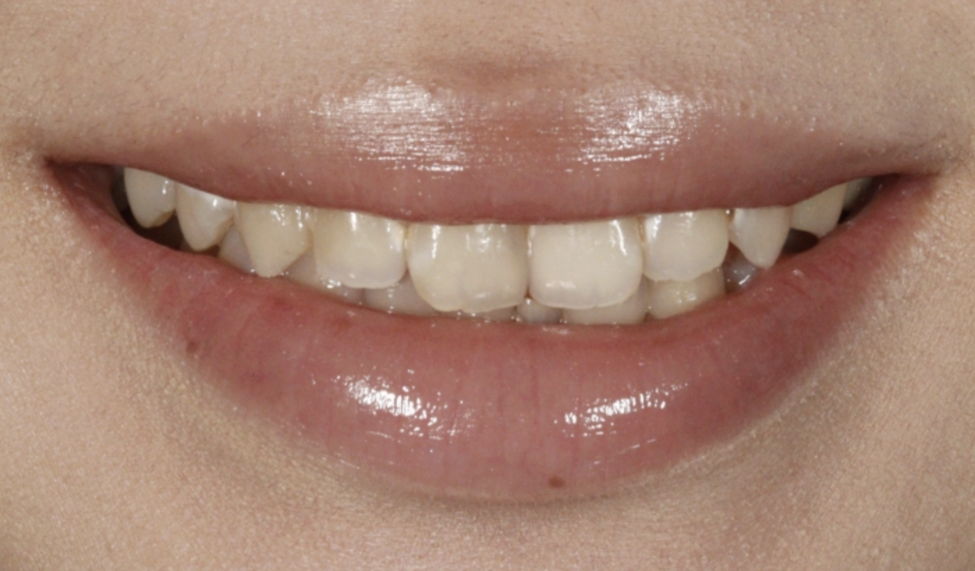 이○○님 치료 전