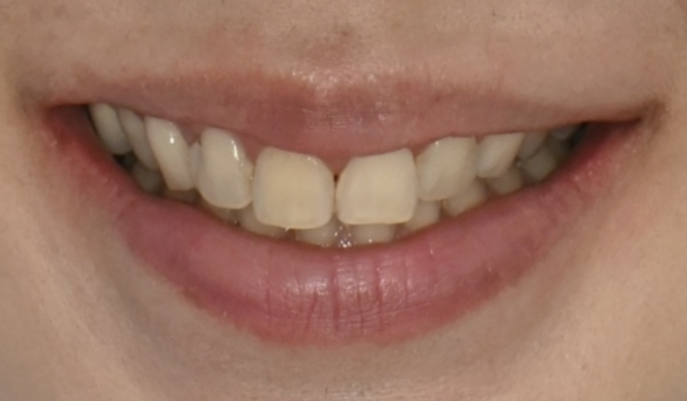 박○○님 치료 전